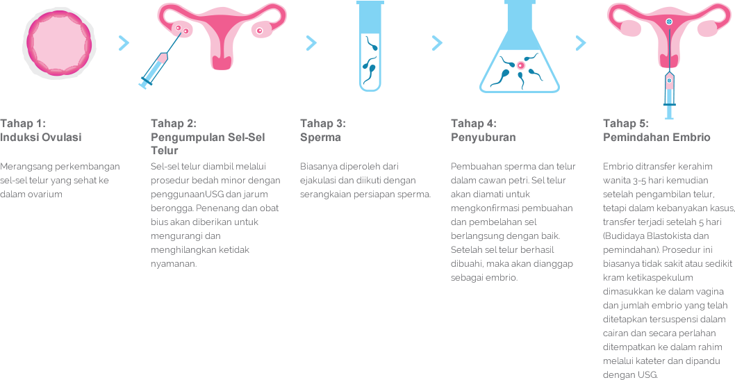  Fertilisasi In Vitro  IVF Alpha IVF Women s Specialists