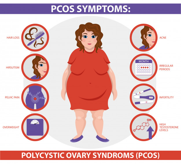Polikistik sindrom ovarium Polycystic Ovarian